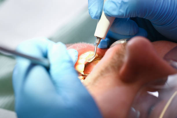 Best Emergency Denture Repair in Texas City, TX